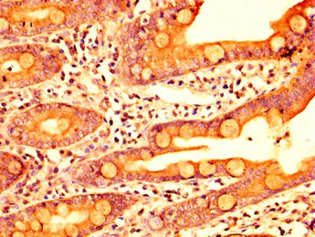 Immunohistochemistry (Formalin/PFA-fixed paraffin-embedded sections) - Anti-HEXO antibody (AB236945)