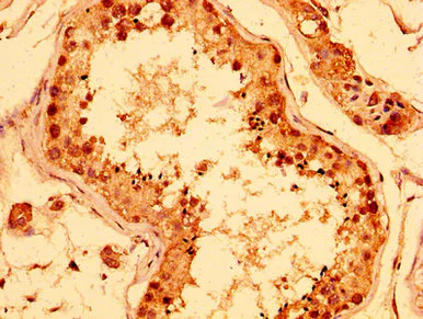 Immunohistochemistry (Formalin/PFA-fixed paraffin-embedded sections) - Anti-HEXO antibody (AB236945)