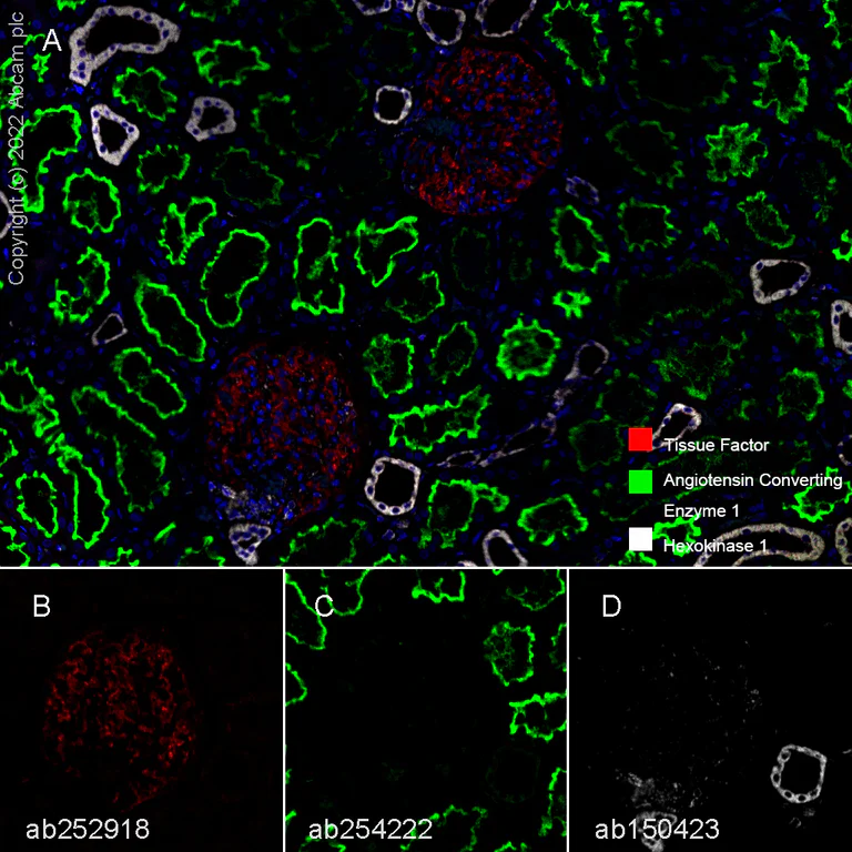 Multiplex immunohistochemistry - Anti-Hexokinase 1 antibody [EPR10134(B)] - BSA and Azide free (AB233837)