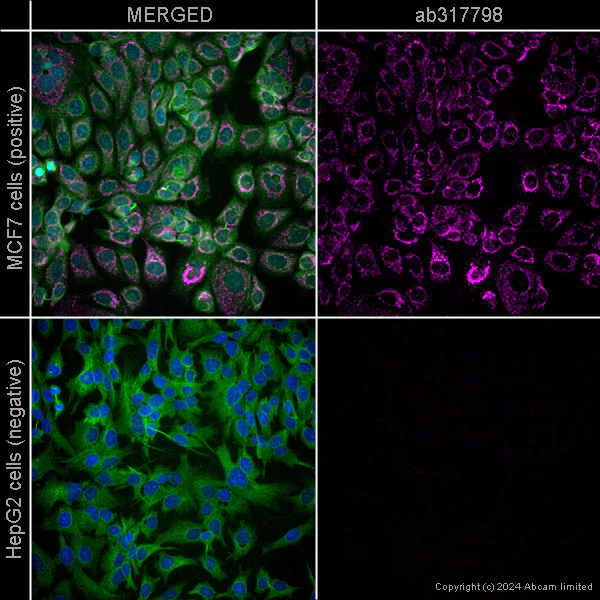 Immunocytochemistry/ Immunofluorescence - Anti-Hexokinase 1 antibody [EPR10134(B)] - Mitochondrial OMM – Mouse IgG1 (Chimeric) (AB317788)