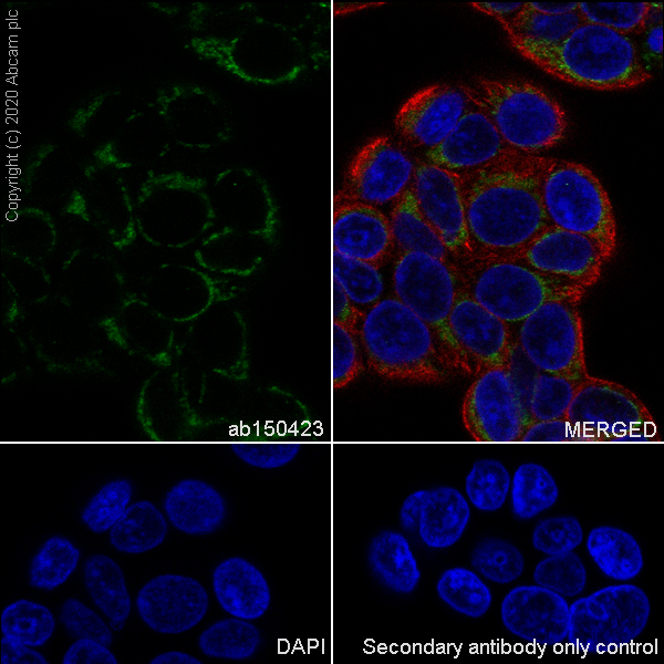 Immunocytochemistry/ Immunofluorescence - Anti-Hexokinase 1 antibody [EPR10134(B)] - Mitochondrial Outer Membrane Marker (AB150423)