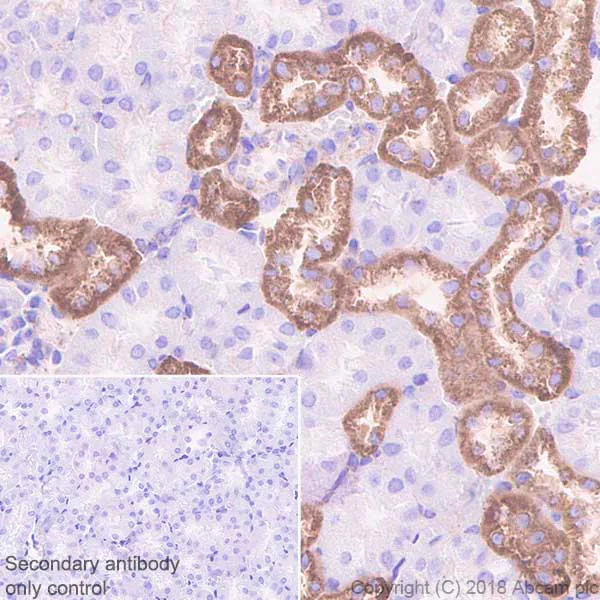 Immunohistochemistry (Formalin/PFA-fixed paraffin-embedded sections) - Anti-Hexokinase 1 antibody [EPR10134(B)] - Mitochondrial Outer Membrane Marker (AB150423)