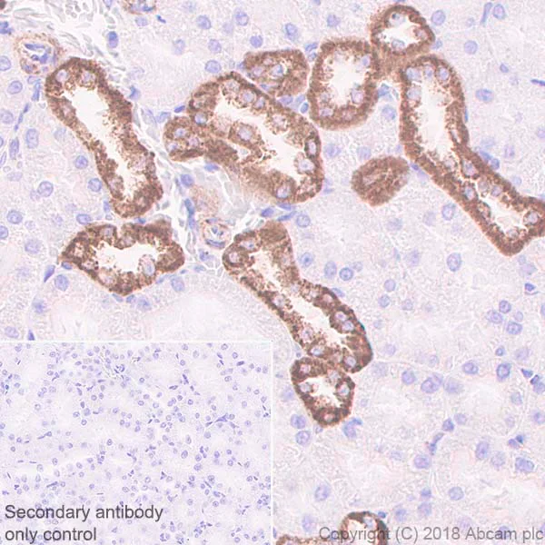 Immunohistochemistry (Formalin/PFA-fixed paraffin-embedded sections) - Anti-Hexokinase 1 antibody [EPR10134(B)] - Mitochondrial Outer Membrane Marker (AB150423)