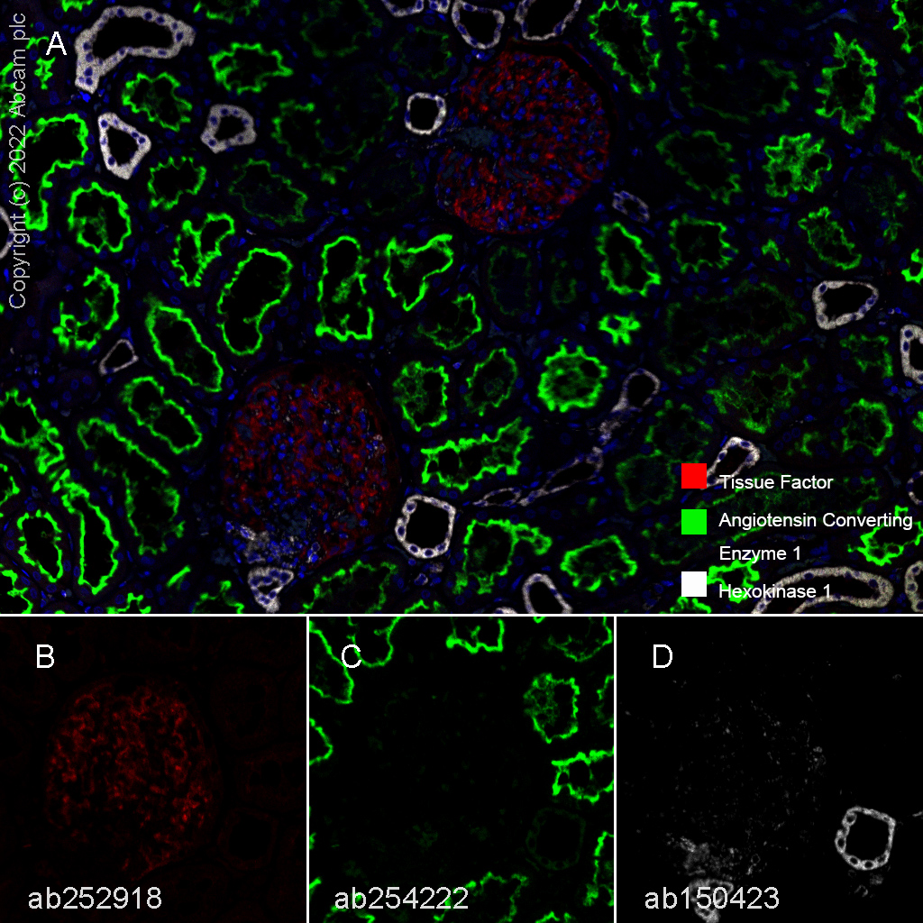 Multiplex immunohistochemistry - Anti-Hexokinase 1 antibody [EPR10134(B)] - Mitochondrial Outer Membrane Marker (AB150423)