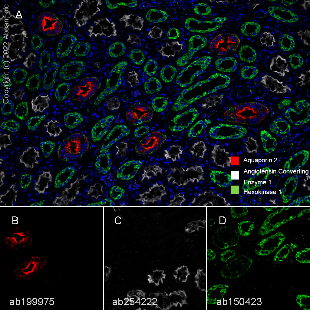 Anti-Hexokinase 1 antibody [EPR10134(B)] - Mitochondrial Outer