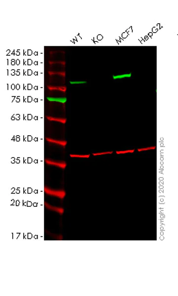Western blot - Anti-Hexokinase 1 antibody [EPR10134(B)] - Mitochondrial Outer Membrane Marker (AB150423)