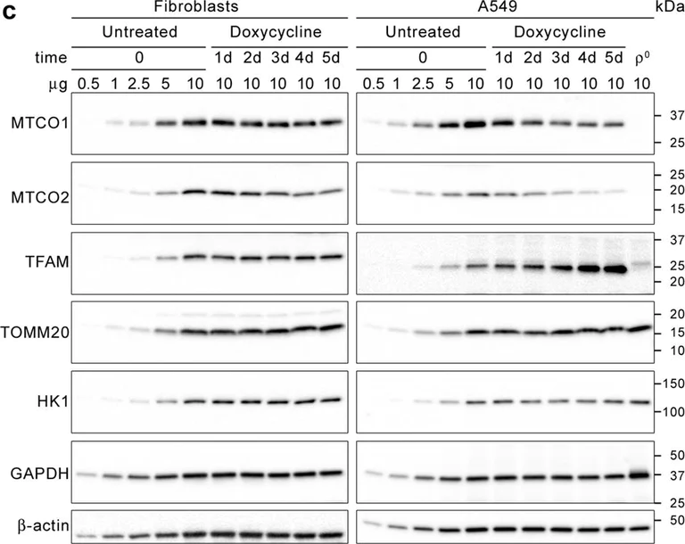 Western blot - Anti-Hexokinase 1 antibody [EPR10134(B)] - Mitochondrial Outer Membrane Marker (AB150423)