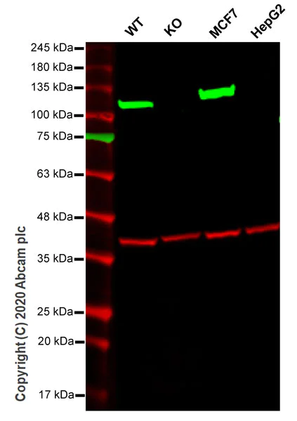 Western blot - Anti-Hexokinase 1 antibody [EPR10134(B)] - Mitochondrial Outer Membrane Marker (AB150423)