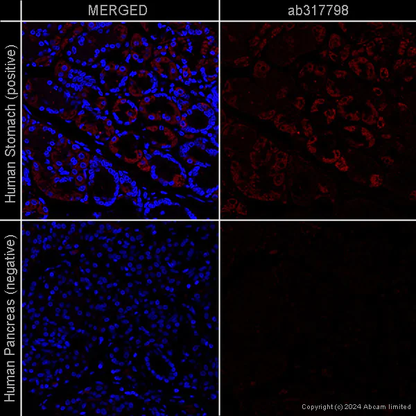 Immunohistochemistry (Formalin/PFA-fixed paraffin-embedded sections) - Anti-Hexokinase 1 antibody [EPR10134(B)] – Mouse IgG1 (Chimeric) – BSA and Azide Free (AB317798)