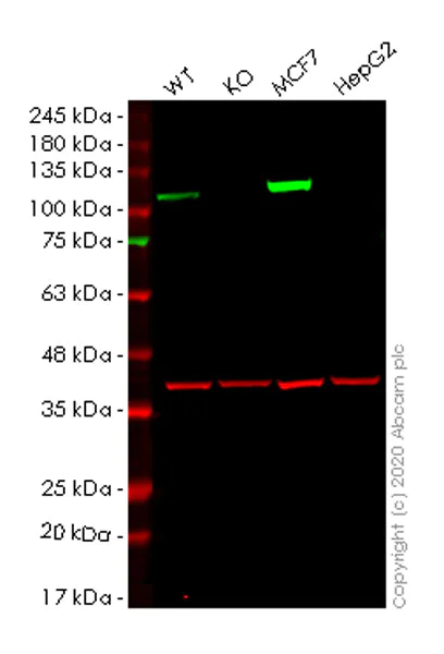 Western blot - Anti-Hexokinase 1 antibody [EPR10135(B)] (AB154839)