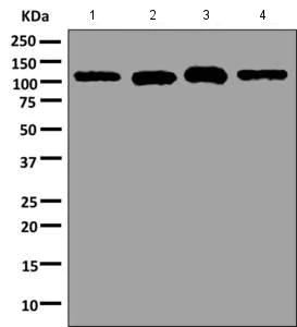 Western blot - Anti-Hexokinase 1 antibody [EPR10135(B)] (AB154839)