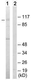 Western blot - Anti-Hexokinase 1 antibody - Mitochondrial Outer Membrane Marker (AB65069)
