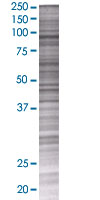 SDS-PAGE - Hexokinase 1 overexpression 293T lysate (whole cell) (AB94049), expandable thumbnail