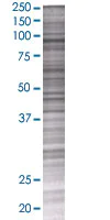 SDS-PAGE - Hexokinase 1 overexpression 293T lysate (whole cell) (AB94049)