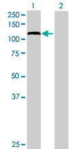 Western blot - Hexokinase 1 overexpression 293T lysate (whole cell) (AB94049), expandable thumbnail