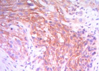 Immunohistochemistry (Formalin/PFA-fixed paraffin-embedded sections) - Anti-Hexokinase II antibody [3D3] (AB104836)
