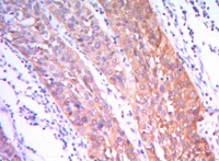Immunohistochemistry (Formalin/PFA-fixed paraffin-embedded sections) - Anti-Hexokinase II antibody [3D3] (AB104836)