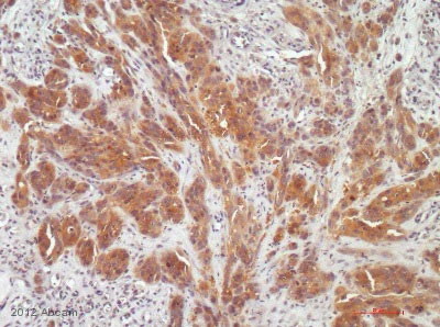 Immunohistochemistry (Formalin/PFA-fixed paraffin-embedded sections) - Anti-Hexokinase II antibody [3D3] (AB104836)