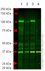 Western blot - Anti-Hexokinase II antibody [3D3] (AB104836)
