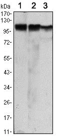 Western blot - Anti-Hexokinase II antibody [3D3] (AB104836)