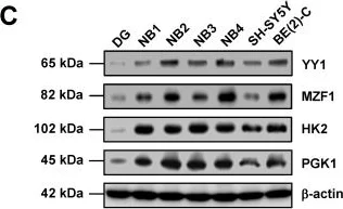 Western blot - Anti-Hexokinase II antibody [3D3] (AB104836)