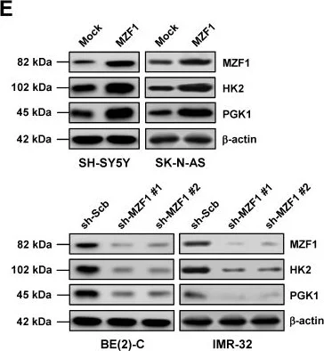 Western blot - Anti-Hexokinase II antibody [3D3] (AB104836)