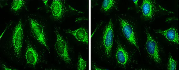 Immunocytochemistry/ Immunofluorescence - Anti-Hexokinase II antibody (AB227198)
