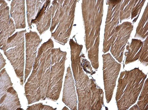 Immunohistochemistry (Formalin/PFA-fixed paraffin-embedded sections) - Anti-Hexokinase II antibody (AB227198)