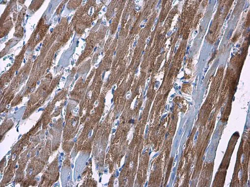 Immunohistochemistry (Formalin/PFA-fixed paraffin-embedded sections) - Anti-Hexokinase II antibody (AB227198)