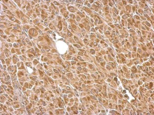 Immunohistochemistry (Formalin/PFA-fixed paraffin-embedded sections) - Anti-Hexokinase II antibody (AB227198)