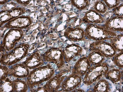 Immunohistochemistry (Formalin/PFA-fixed paraffin-embedded sections) - Anti-Hexokinase II antibody (AB227198)