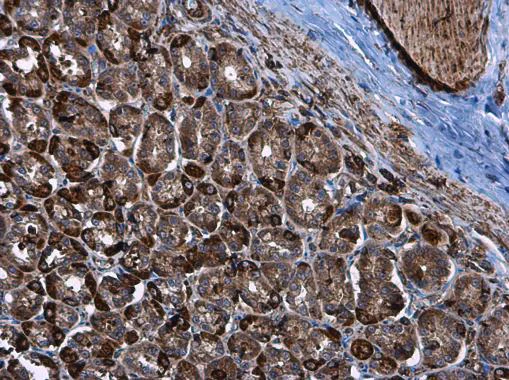 Immunohistochemistry (Formalin/PFA-fixed paraffin-embedded sections) - Anti-Hexokinase II antibody (AB227198)