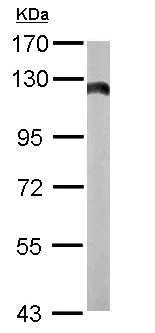 Western blot - Anti-Hexokinase II antibody (AB227198)