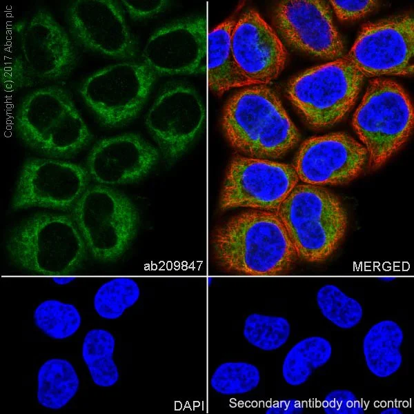 Immunocytochemistry/ Immunofluorescence - Anti-Hexokinase II antibody [EPR20839] (AB209847)
