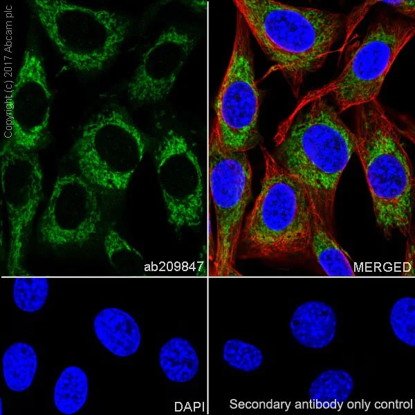 Immunocytochemistry/ Immunofluorescence - Anti-Hexokinase II antibody [EPR20839] (AB209847)