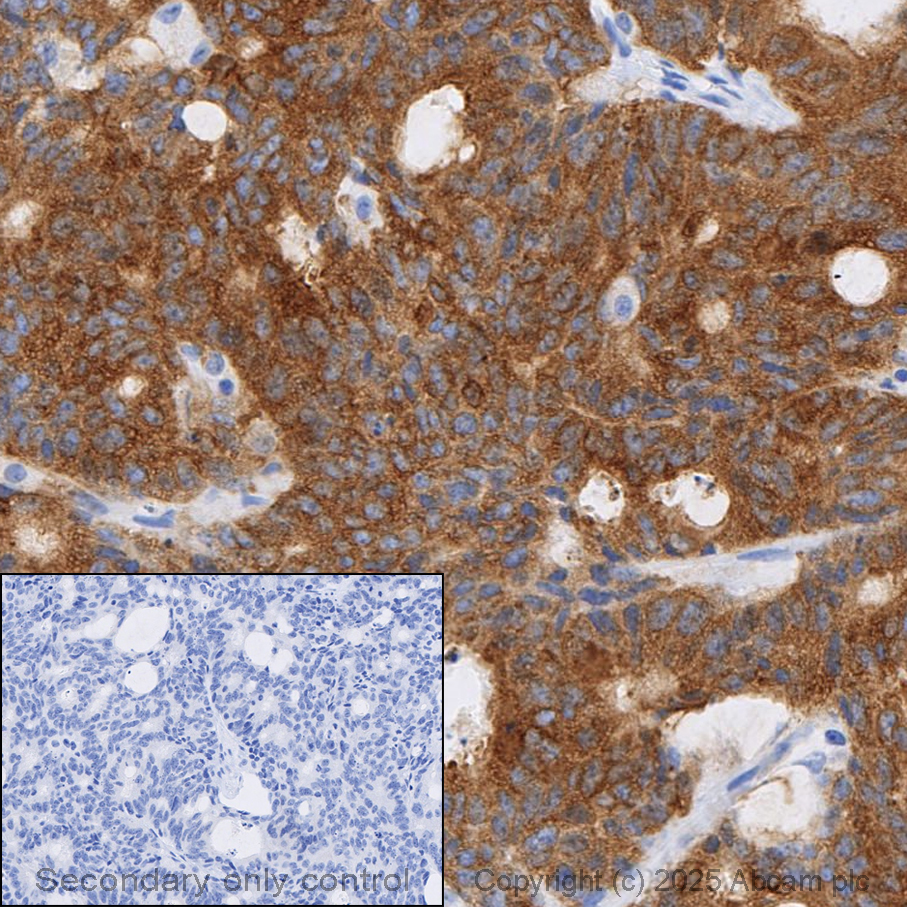 Anti-Hexokinase II antibody [EPR20839]