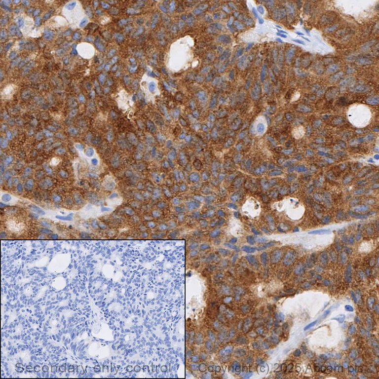 Immunohistochemistry (Formalin/PFA-fixed paraffin-embedded sections) - Anti-Hexokinase II antibody [EPR20839] (AB209847)