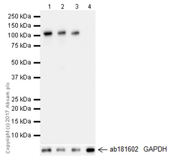 Western blot - Anti-Hexokinase II antibody [EPR20839] (AB209847)
