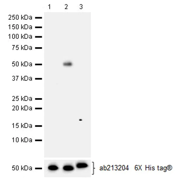 Western blot - Anti-Hexokinase II antibody [EPR20839] (AB209847)
