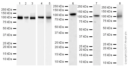 Western blot - Anti-Hexokinase II antibody [EPR20839] (AB209847)