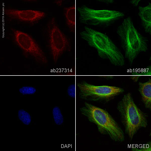 Immunocytochemistry/ Immunofluorescence - Anti-Hexokinase II antibody [EPR20839] - BSA and Azide free (AB228819)