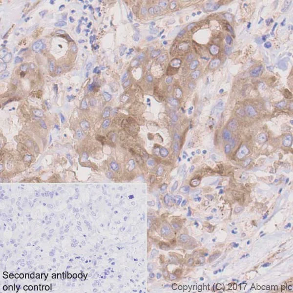 Immunohistochemistry (Formalin/PFA-fixed paraffin-embedded sections) - Anti-Hexokinase II antibody [EPR20839] - BSA and Azide free (AB228819)