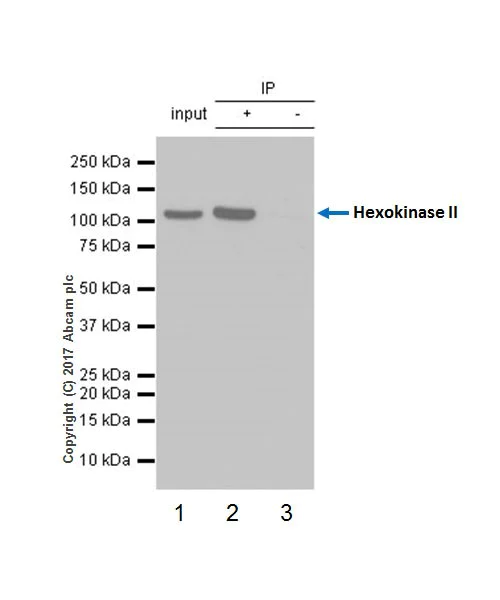 Immunoprecipitation - Anti-Hexokinase II antibody [EPR20839] - BSA and Azide free (AB228819)