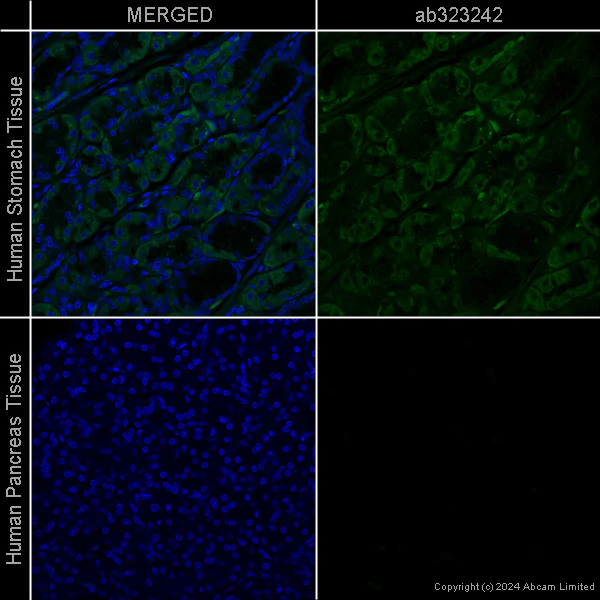 Immunohistochemistry (Formalin/PFA-fixed paraffin-embedded sections) - Anti-Hexokinase II antibody [EPR20839] – Mouse IgG1 (Chimeric) – BSA and Azide Free (AB323251)