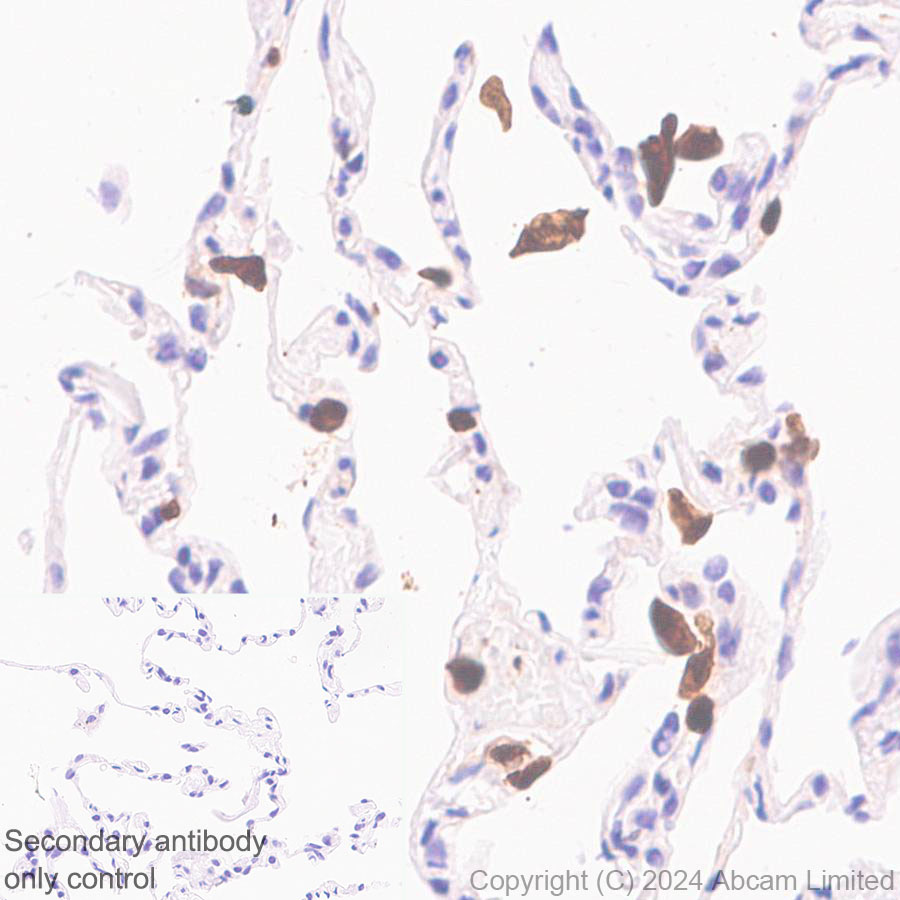 Immunohistochemistry (Formalin/PFA-fixed paraffin-embedded sections) - Anti-Hexokinase Type III/HK3 antibody [EPR29196-29] (AB321996), expandable thumbnail