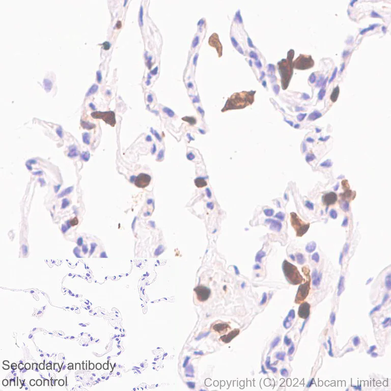Immunohistochemistry (Formalin/PFA-fixed paraffin-embedded sections) - Anti-Hexokinase Type III/HK3 antibody [EPR29196-29] (AB321996)