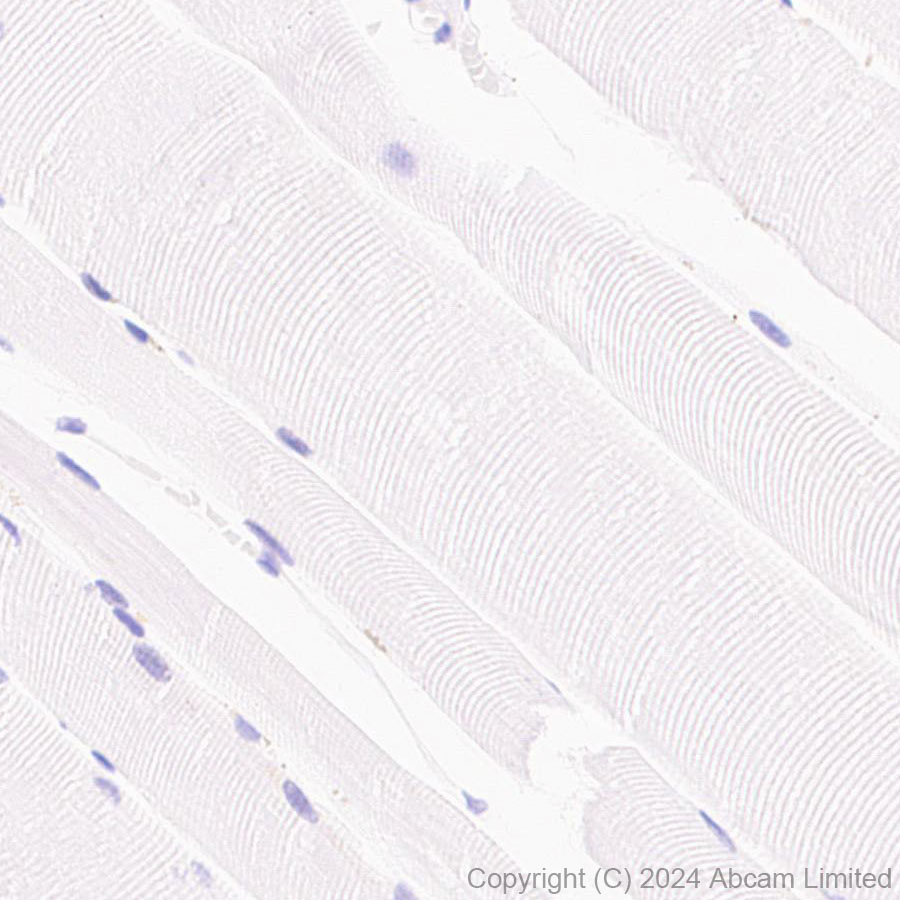 Immunohistochemistry (Formalin/PFA-fixed paraffin-embedded sections) - Anti-Hexokinase Type III/HK3 antibody [EPR29196-29] (ab321996), expandable thumbnail