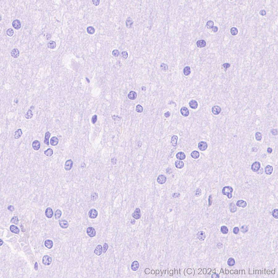 Immunohistochemistry (Formalin/PFA-fixed paraffin-embedded sections) - Anti-Hexokinase Type III/HK3 antibody [EPR29196-29] (AB321996), expandable thumbnail