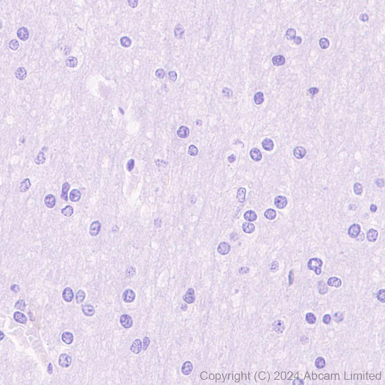 Immunohistochemistry (Formalin/PFA-fixed paraffin-embedded sections) - Anti-Hexokinase Type III/HK3 antibody [EPR29196-29] (AB321996)