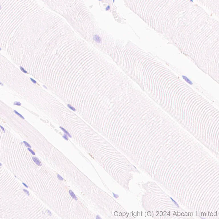 Immunohistochemistry (Formalin/PFA-fixed paraffin-embedded sections) - Anti-Hexokinase Type III/HK3 antibody [EPR29196-29] - BSA and Azide free (AB321997)